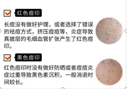渐进磨削_9.png