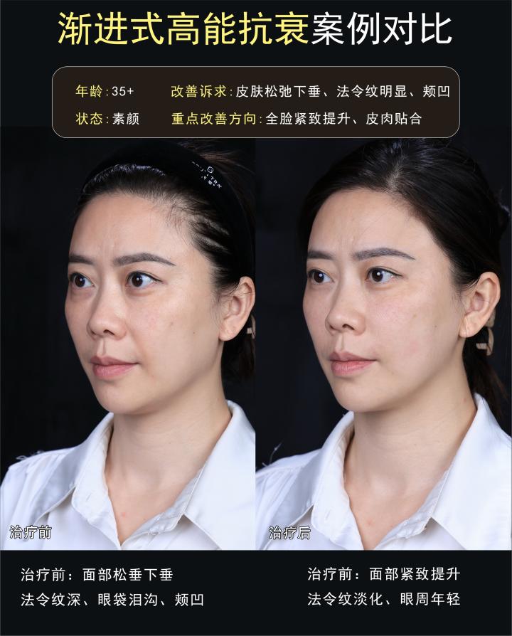 画板 1 拷贝.jpg