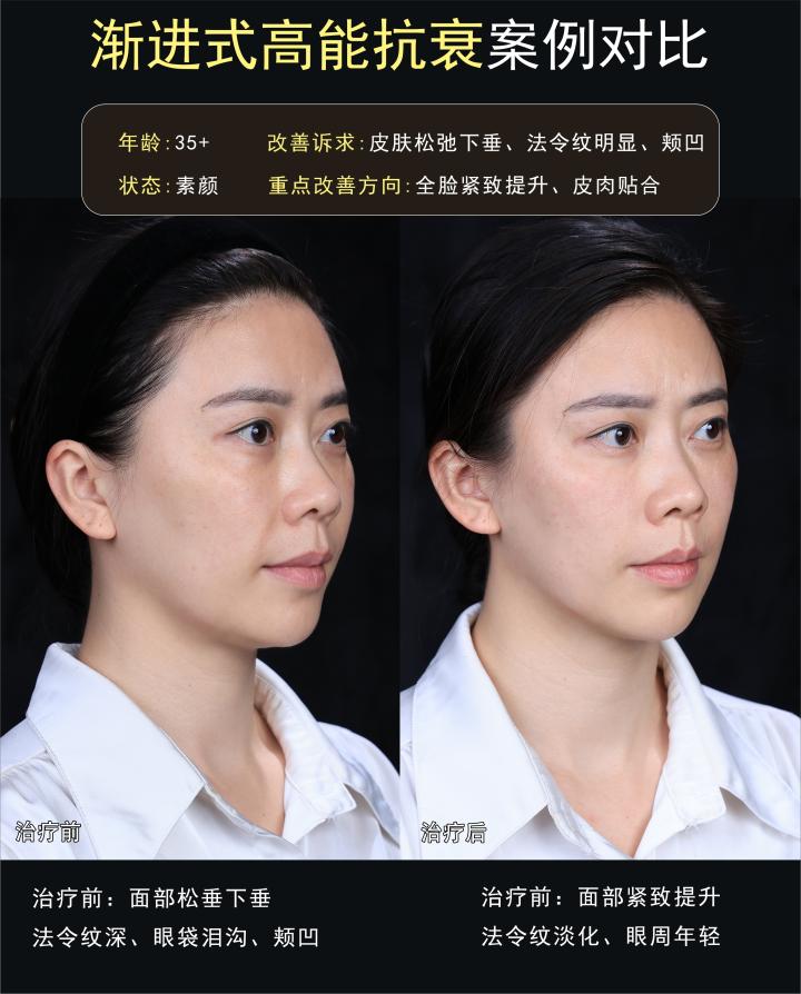 画板 1 拷贝 2.jpg