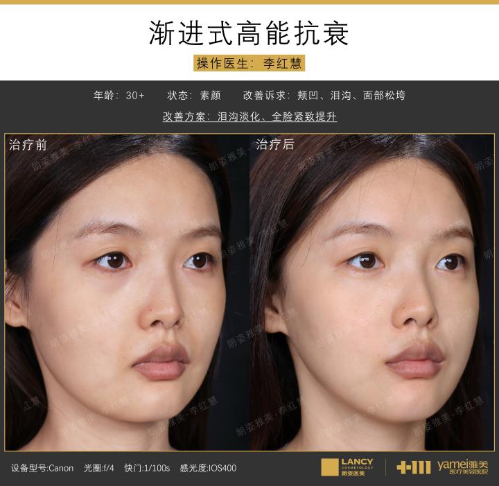画板 1 拷贝 2.jpg