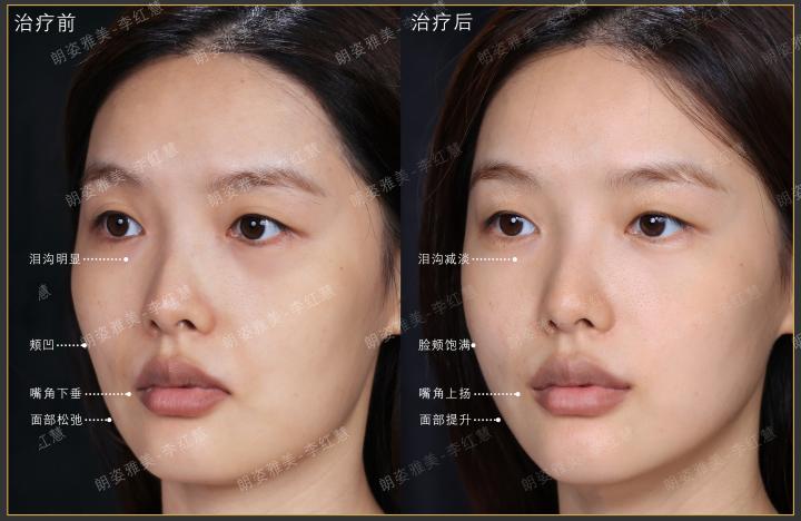 画板 1 拷贝 4.jpg