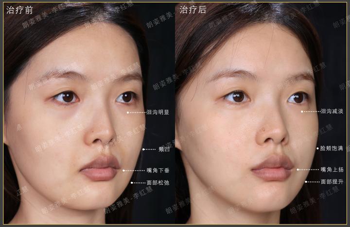 画板 1 拷贝 5.jpg