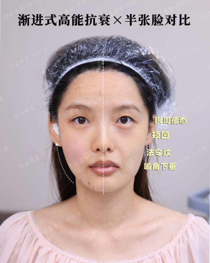 半边脸对比.jpg
