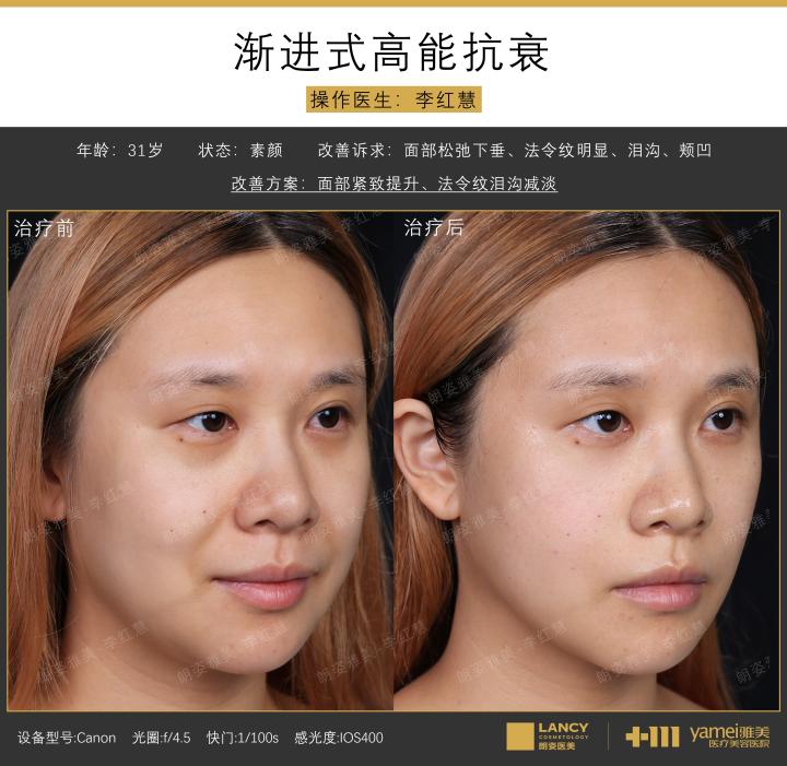 画板 1 拷贝.1.jpg