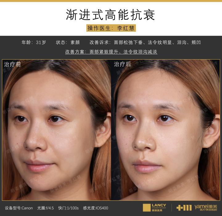 画板 1 拷贝 2.1.jpg