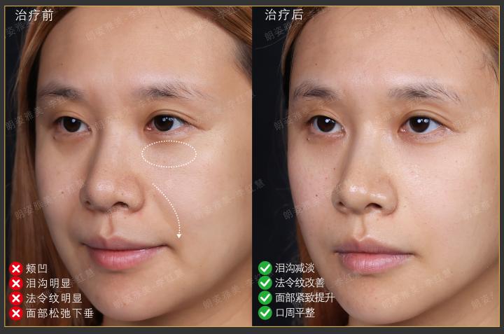 画板 1 拷贝 5.jpg