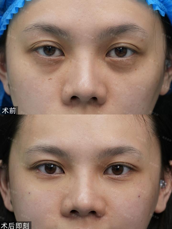 66bfed3b-e8ed-4351-adf6-41f68a169ae2.jpg