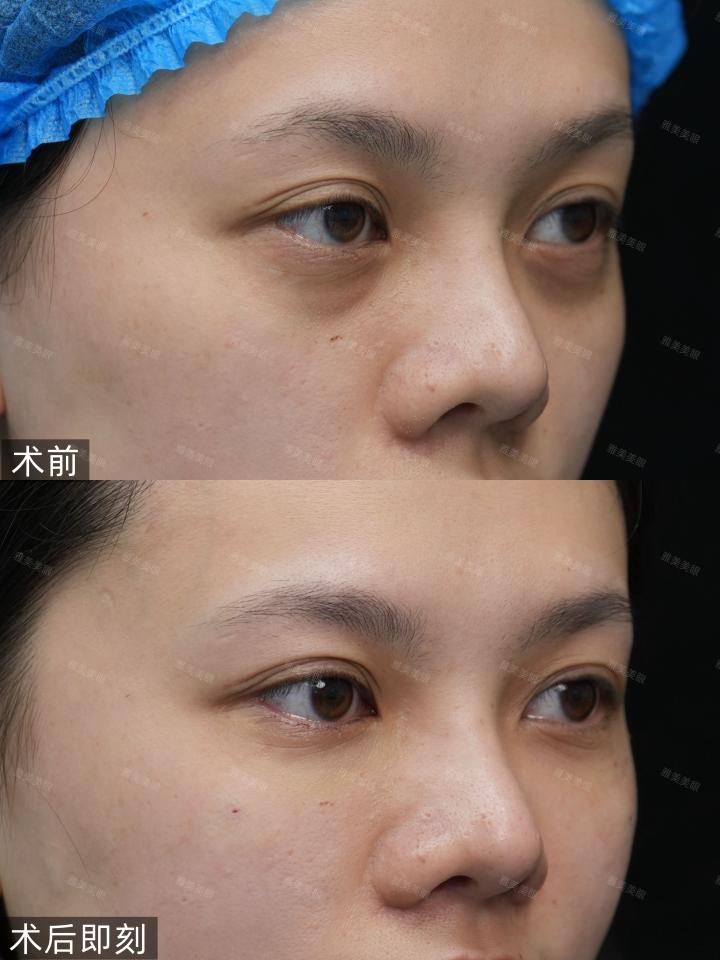 a1318f82-ad43-4028-bb44-21d44c9cf3d5.jpg